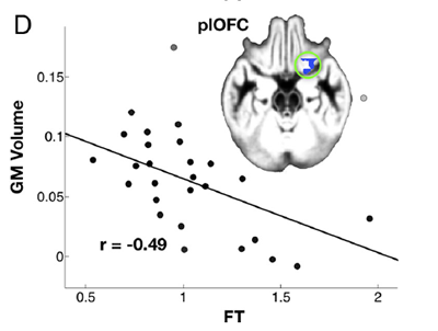 foetal testosterone weak relationship to brain gender